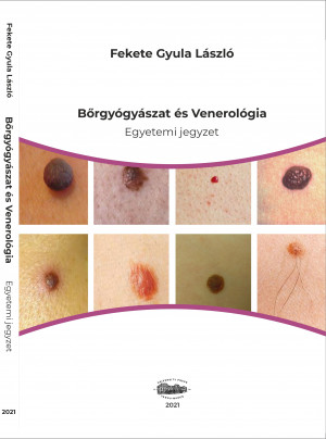 Bőrgyógyászat és Venerológia - Egyetemi jegyzet (2. bővítet kiadás.)