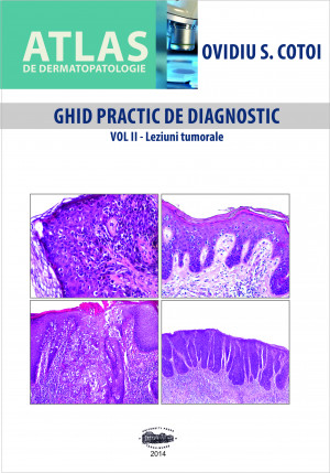 GHID PRACTIC DE DIAGNOSTIC VOL II - Leziuni tumorale
