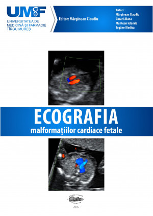 ECOGRAFIA Malformațiilor Cardiace Fetale  broșură +DVD