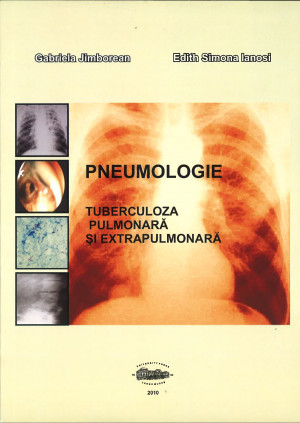 PNEUMOLOGIE - Tuberculoza pulmonară și extrapulmonară